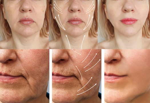 facial cosmetic surgeries